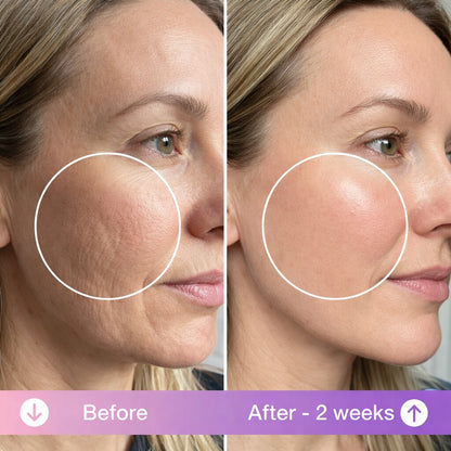 Veloura™ Anti-Wrinkle Beauty Pillow